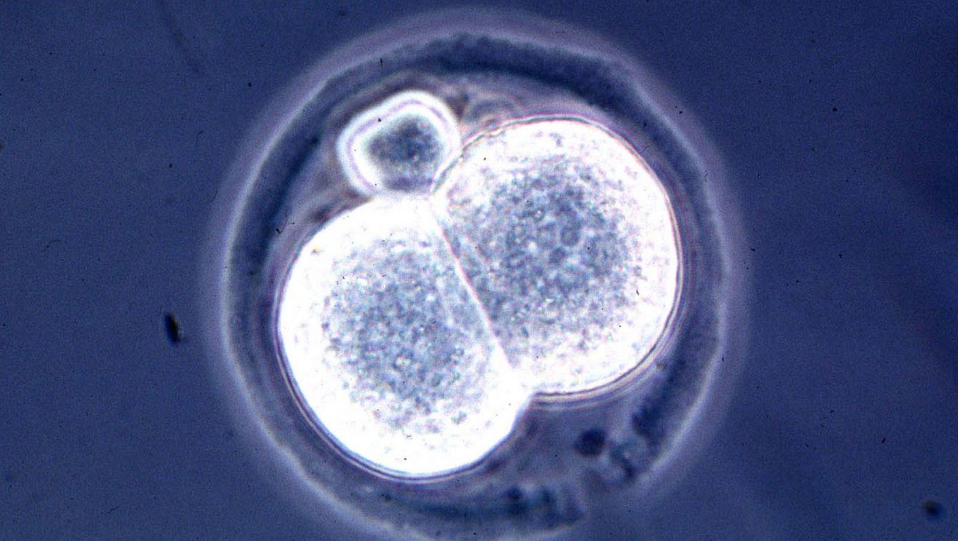 Dwukomórkowy zarodek myszy widziany pod mikroskopem. Ten zarodek powstał w wyniku klonowania. Fot. Getty Images