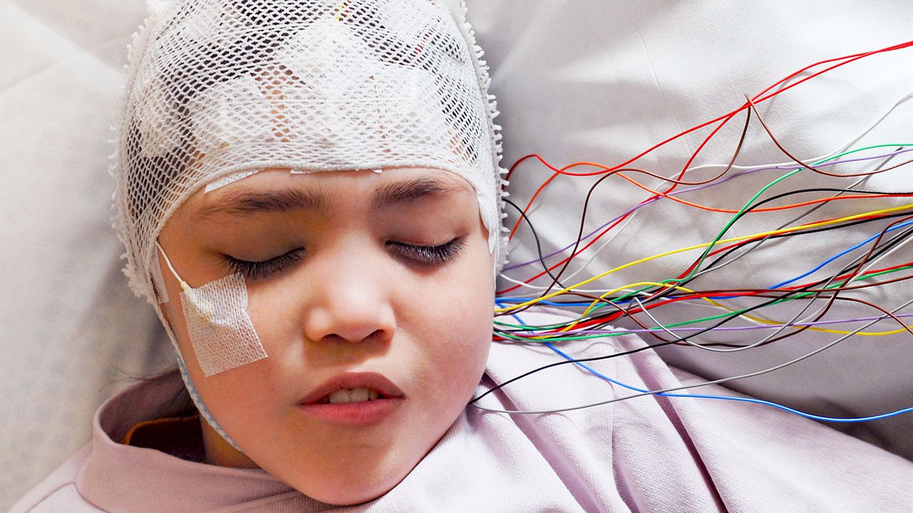 Odejście od diagnostyki objawowej – bo napady najlepiej widać – ku poszukiwaniom podłoża, które bywa głęboko ukryte (fot. Shutterstock/vasara) Odejście od diagnostyki objawowej – bo napady najlepiej widać – ku poszukiwaniom podłoża, które bywa głęboko ukryte (fot. Shutterstock/vasara)